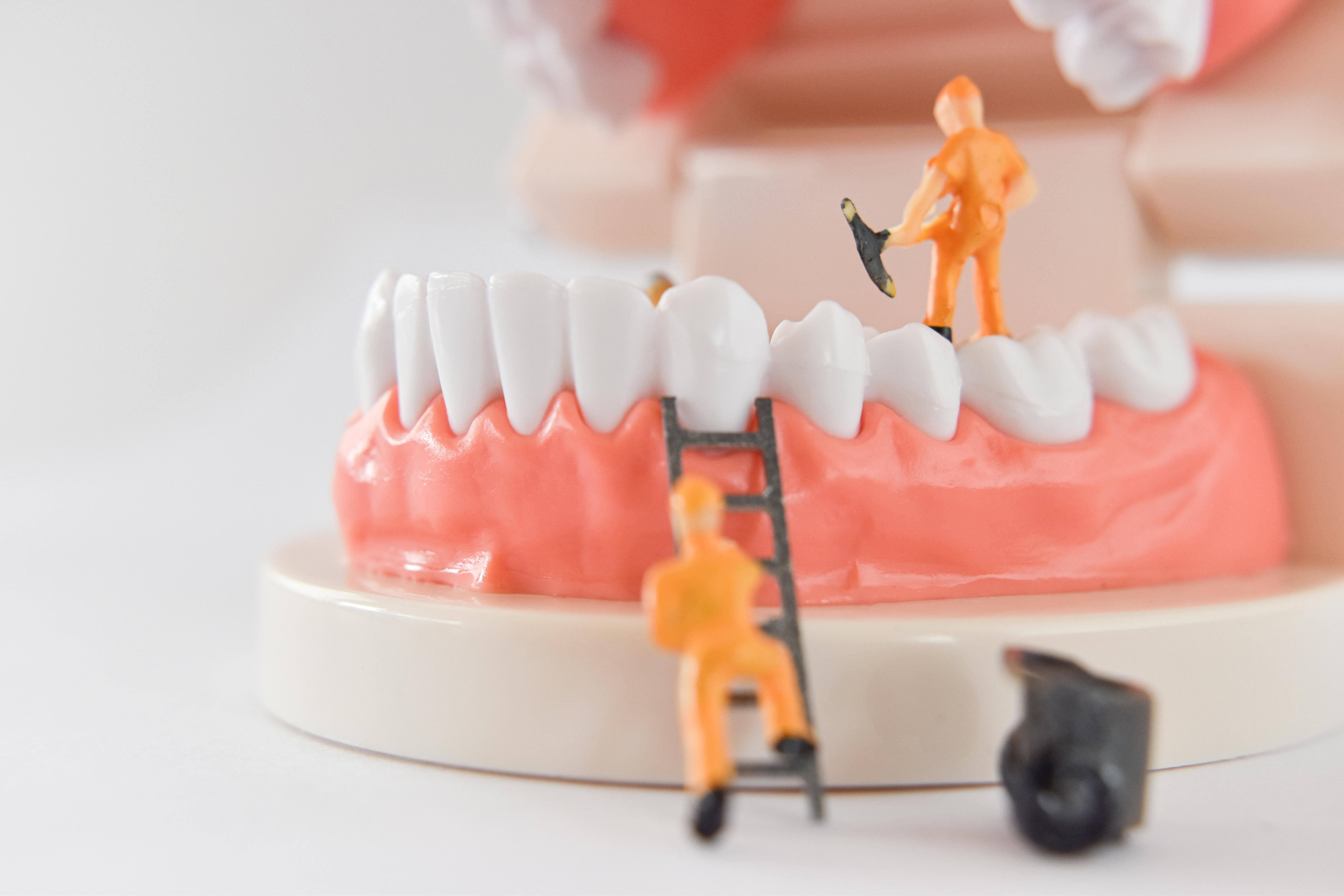 Denture repairs