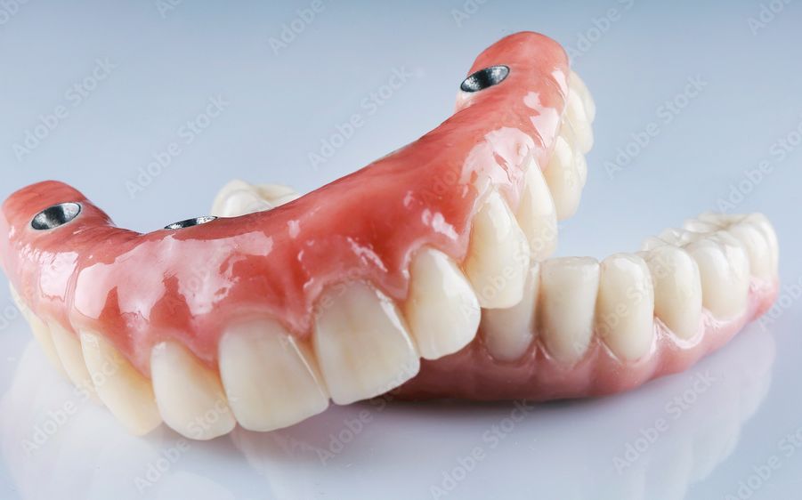 Denture repairs